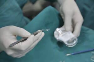 Cataract Surgery IOL