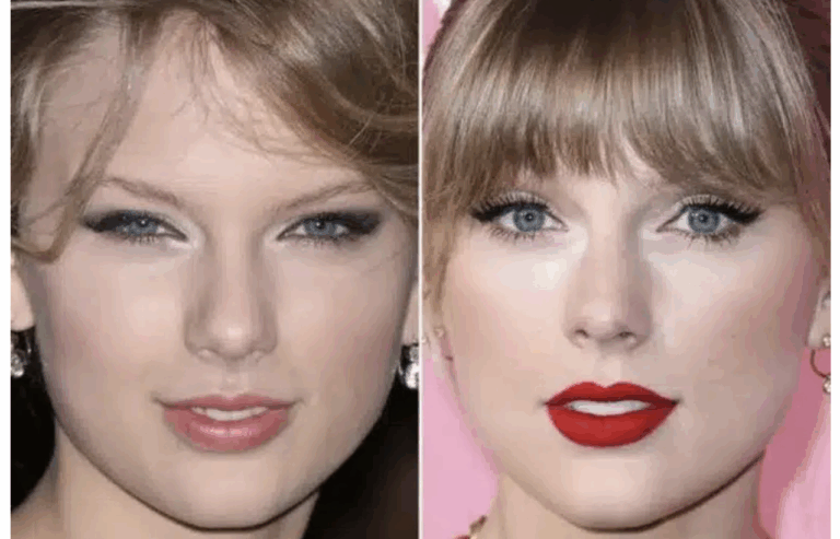 Before and after celebrity eye treatments showing brighter, healthier eyes